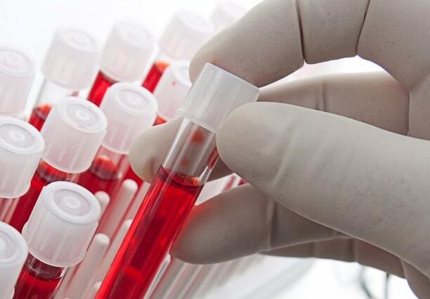 análisis de sangre después de beber alcohol